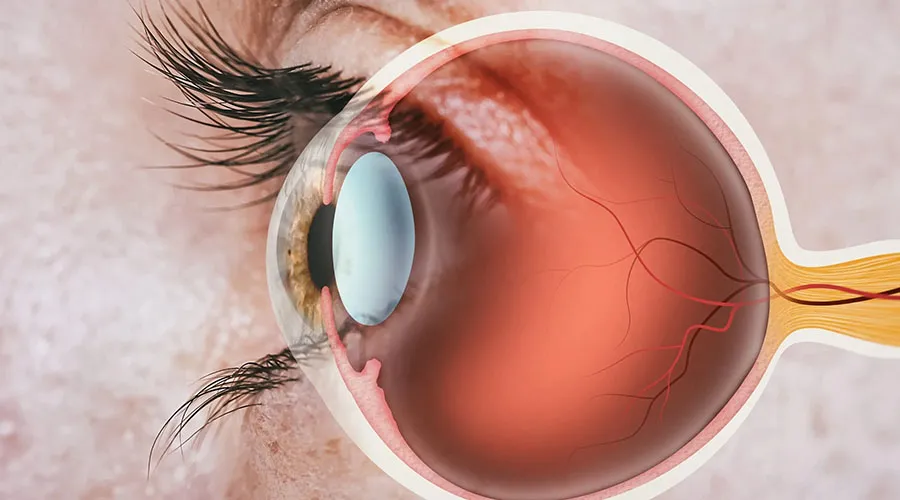Image of retina care eye examination